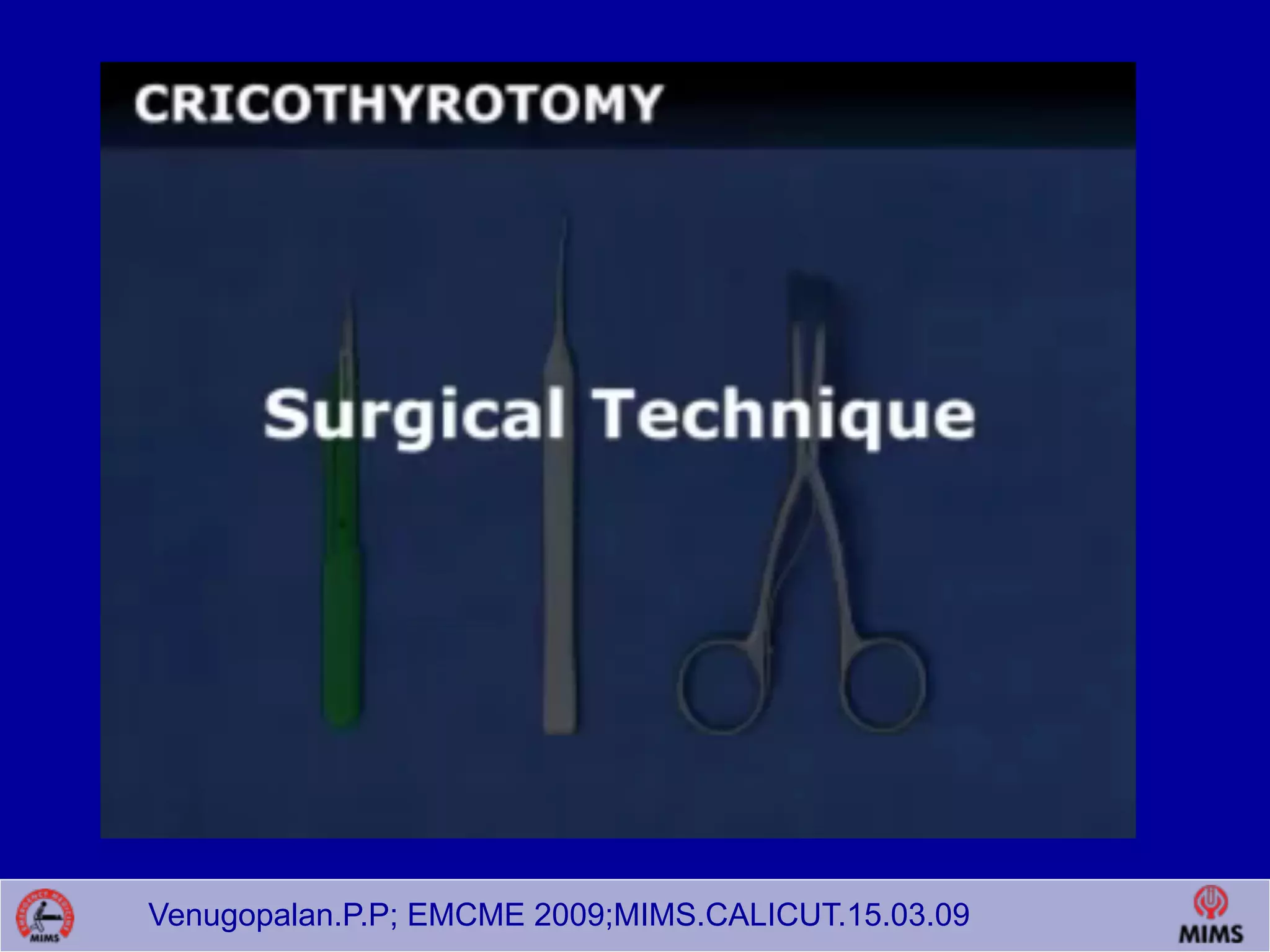 Venugopalan.P.P; EMCME 2009;MIMS.CALICUT.15.03.09
 