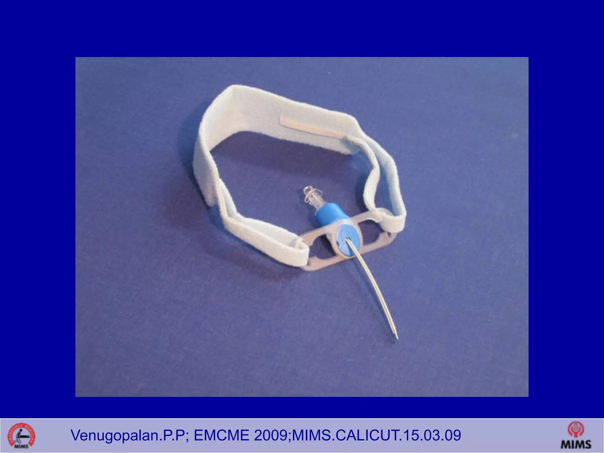 Venugopalan.P.P; EMCME 2009;MIMS.CALICUT.15.03.09
 