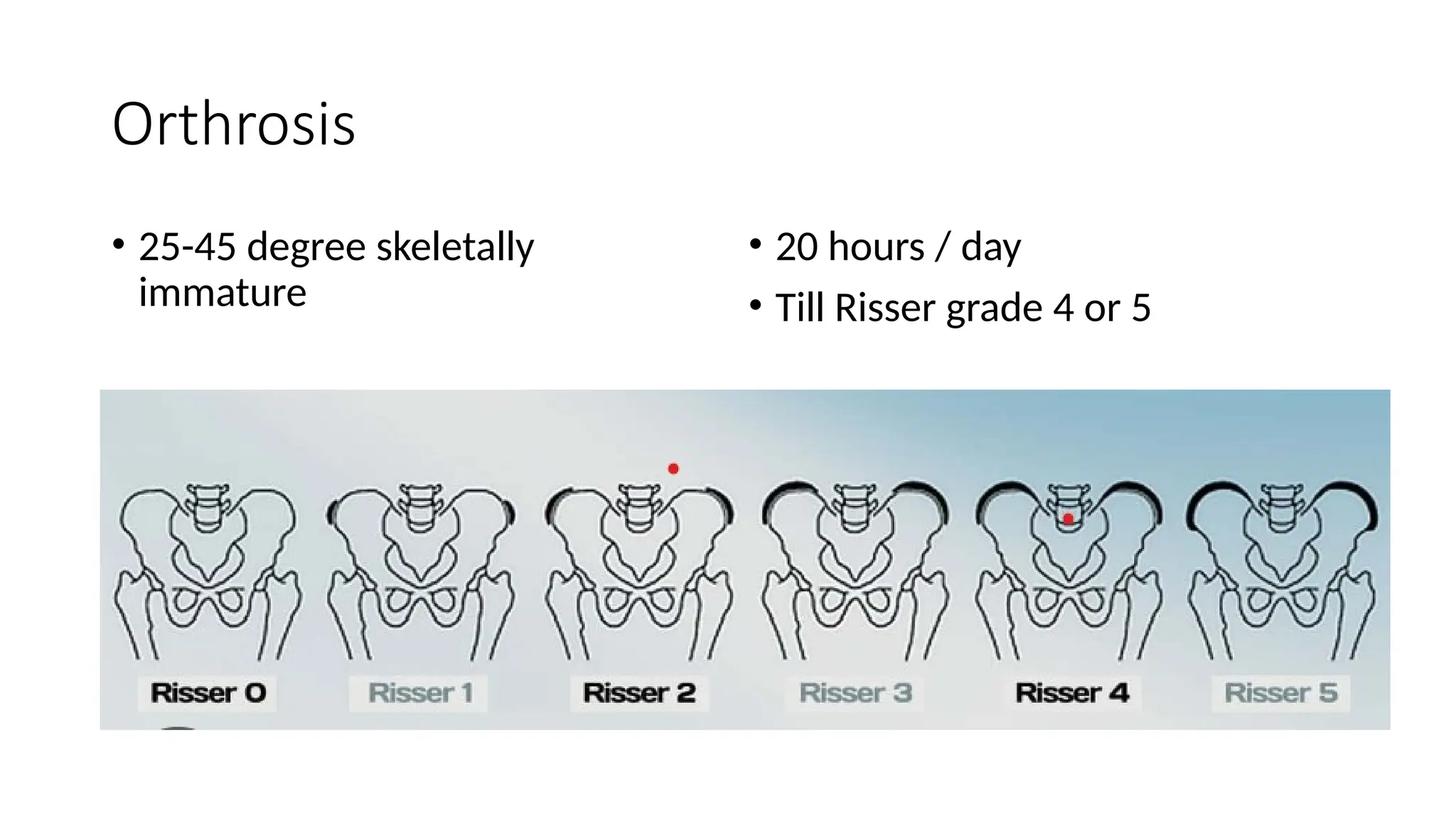 Adolescent Idiopathic Scoliosis Overview | PPTX