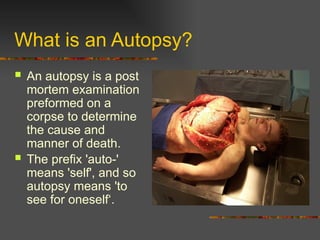 Comprehensive Guide to Forensic Autopsy Procedures and Classifications ...