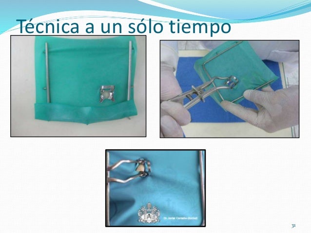 Técnica de Aislamiento