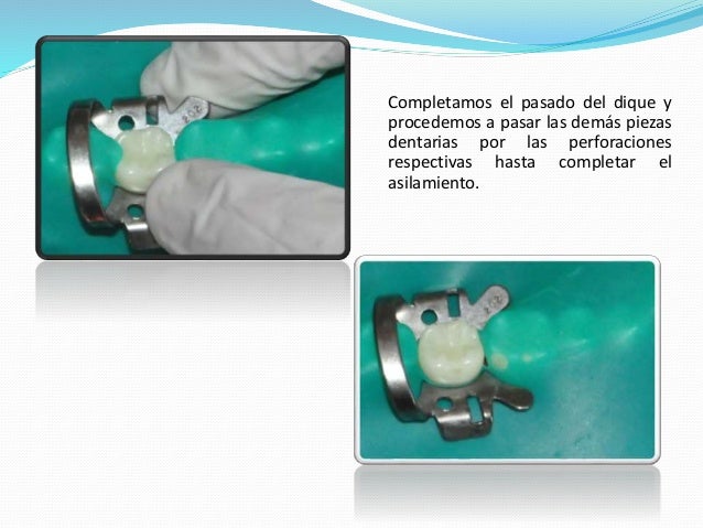 Técnica de Aislamiento