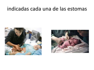 indicadas cada una de las estomas
 