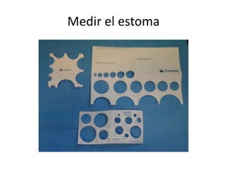Medir el estoma
 