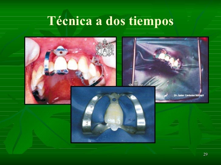 Aislamiento absoluto