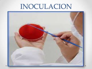 INOCULACION