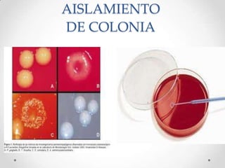 AISLAMIENTO
DE COLONIA