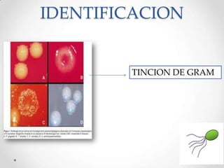 IDENTIFICACION
TINCION DE GRAM