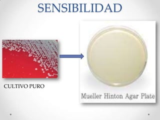 SENSIBILIDAD
CULTIVO PURO