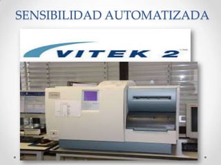 SENSIBILIDAD AUTOMATIZADA