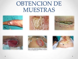 OBTENCION DE
MUESTRAS