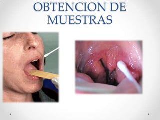 OBTENCION DE
MUESTRAS