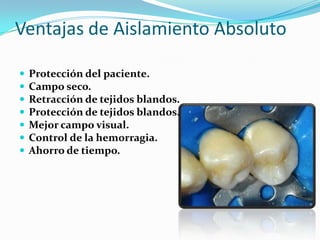 Ventajas de Aislamiento Absoluto<br />Protección del paciente.<br />Campo seco.<br />Retracción de tejidos blandos.<br />P...