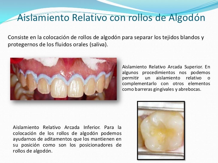 Aislamiento del campo operatorio en operatoria dental Aislamiento del campo operatorio en operatoria dental