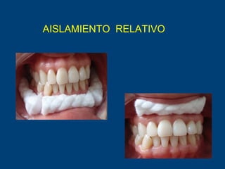 AISLAMIENTO RELATIVO
 