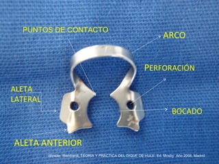 ARCO
ALETA
LATERAL
PERFORACIÓN
ALETA ANTERIOR
PUNTOS DE CONTACTO
BOCADO
Winkler Reinhardt, TEORIA Y PRÁCTICA DEL DIQUE DE HULE, Ed. Mosby Año 2008, Madrid
 