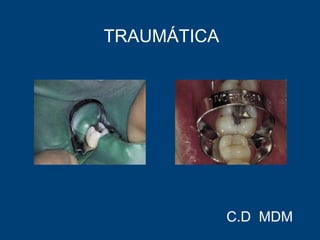 TRAUMÁTICA
C.D MDM
 