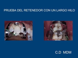 PRUEBA DEL RETENEDOR CON UN LARGO HILO
C.D MDM
 