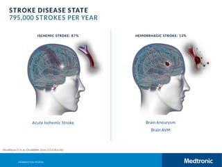 Acute Ischemic Stroke Changing Landscape | PPTX