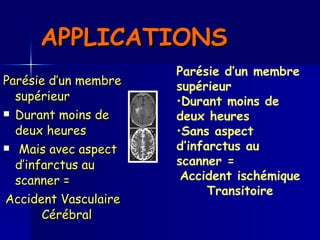 APPLICATIONS  Parésie d’un membre supérieur  Durant moins de deux heures Mais avec aspect d’infarctus au scanner = Accident Vasculaire Cérébral  Parésie d’un membre supérieur Durant moins de deux heures  Sans aspect d’infarctus au scanner = Accident ischémique Transitoire 