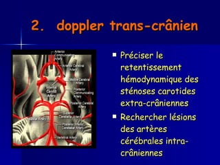 2.  doppler trans-crânien   Préciser le retentissement hémodynamique des sténoses carotides extra-crâniennes Rechercher lésions des artères cérébrales intra-crâniennes  