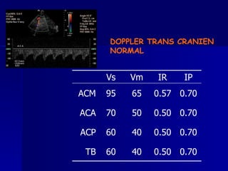 DOPPLER TRANS CRANIEN  NORMAL   0.70 0.50 40 60 TB 0.70 0.50 40 60 ACP 0.70 0.50 50 70 ACA 0.70 0.57 65 95 ACM IP IR Vm Vs 
