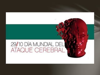 Accidente isquemico transitorio