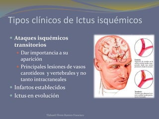 Tipos clínicos de Ictus isquémicos
 Ataques isquémicos
 transitorios
   Dar importancia a su
    aparición
   Principales lesiones de vasos
    carotídeos y vertebrales y no
    tanto intracraneales
 Infartos establecidos
 Ictus en evolución


                Tlahuetl Flores Ramiro Francisco
 