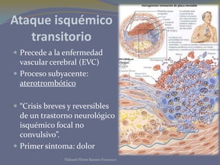 Ataque isquémico
   transitorio
 Precede a la enfermedad
  vascular cerebral (EVC)
 Proceso subyacente:
  aterotrombótico

 “Crisis breves y reversibles
  de un trastorno neurológico
  isquémico focal no
  convulsivo”.
 Primer síntoma: dolor
               Tlahuetl Flores Ramiro Francisco
 