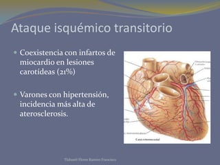 Ataque isquémico transitorio
 Coexistencia con infartos de
 miocardio en lesiones
 carotídeas (21%)

 Varones con hipertensión,
 incidencia más alta de
 aterosclerosis.




              Tlahuetl Flores Ramiro Francisco
 