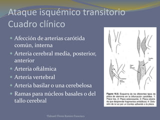 Ataque isquémico transitorio
Cuadro clínico
 Afección de arterias carótida
    común, interna
   Arteria cerebral media, posterior,
    anterior
   Arteria oftálmica
   Arteria vertebral
   Arteria basilar o una cerebelosa
   Ramas para núcleos basales o del
    tallo cerebral

                 Tlahuetl Flores Ramiro Francisco
 