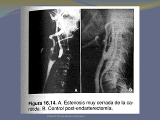 Tlahuetl Flores Ramiro Francisco
 