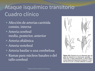 Ataque isquémico transitorio
Cuadro clínico
 Afección de arterias carótida
común, interna
 Arteria cerebral
media, posterior, anterior
 Arteria oftálmica
 Arteria vertebral
 Arteria basilar o una cerebelosa
 Ramas para núcleos basales o del
tallo cerebral
Tlahuetl Flores Ramiro Francisco
 