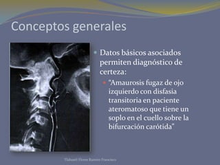 Conceptos generales
 Datos básicos asociados
permiten diagnóstico de
certeza:
 “Amaurosis fugaz de ojo
izquierdo con disfasia
transitoria en paciente
ateromatoso que tiene un
soplo en el cuello sobre la
bifurcación carótida”
Tlahuetl Flores Ramiro Francisco
 