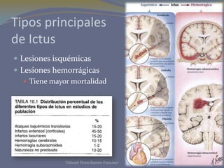 Tipos principales
de Ictus
 Lesiones isquémicas
 Lesiones hemorrágicas
 Tiene mayor mortalidad
Tlahuetl Flores Ramiro Francisco
 