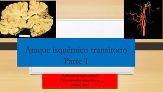 Ataque isquémico transitorio
Parte 1
Guillermo enriquez coronel
Clinicadeparkinsonpuebla.org
Puebla, 2020
 