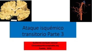 Ataque isquémico
transitorio Parte 3
Guillermo enriquez coronel
Clinicadeparkinsonpuebla.org
Puebla, 2020
 