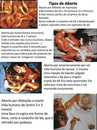Tipos de Aborto
Aborto por Método de Aspiração
Vida humana de 10 a 14 semanas (3 a 4meses)
A foto mostra partes do corpinho do bb já
formado
Nesse método o corpinho do bb é despedaçado
e depois aspirado como um aspirador de pó.
Aborto por hysterotomia (cesariana)
Vida humana de (6 a 7 meses)
O bb é retirado vivo numa cesariana, depois
recebe uma injeção para morrer : /
Depois o corpinho dele é utilizado para
experiências ou vendidos para industrias de
cosméticos para fabricação de produtos de
beleza a base de “colágeno” (credooo)

Aborto por envenenamento por sal
Vida humana de (quase 5 meses)
Uma injeção de líquido salgado
envenena o bb que o engole.
A pele do bb fica toda queimada! Ele
sofre por mais de uma hora e vai
morrendo lentamente.

Aborto por dilatação e morte
Vida humana de (entre 2 e 3
meses)
Uma faca cirurgica em forma de
foice, corta o corpinho do bb, que é
retirado aos pedaços

 