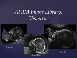 AIUM Image Library:
Obstetrics
First Tri
Third Tri
Second Tri
 