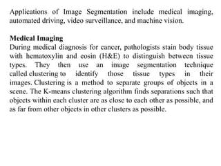 Applications of Image Segmentation include medical imaging,
automated driving, video surveillance, and machine vision.
Medical Imaging
During medical diagnosis for cancer, pathologists stain body tissue
with hematoxylin and eosin (H&E) to distinguish between tissue
types. They then use an image segmentation technique
called clustering to identify those tissue types in their
images. Clustering is a method to separate groups of objects in a
scene. The K-means clustering algorithm finds separations such that
objects within each cluster are as close to each other as possible, and
as far from other objects in other clusters as possible.
 