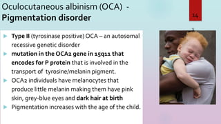 Oculocutaneous albinism (OCA) -
Pigmentation disorder
3/16/2023
14
 Type II (tyrosinase positive) OCA – an autosomal
recessive genetic disorder
 mutation in the OCA2 gene in 15q11 that
encodes for P protein that is involved in the
transport of tyrosine/melanin pigment.
 OCA2 individuals have melanocytes that
produce little melanin making them have pink
skin, grey-blue eyes and dark hair at birth
 Pigmentation increases with the age of the child.
 