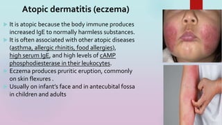 19
 It is atopic because the body immune produces
increased IgE to normally harmless substances.
 It is often associated with other atopic diseases
(asthma, allergic rhinitis, food allergies),
high serum IgE, and high levels of cAMP
phosphodiesterase in their leukocytes.
 Eczema produces pruritic eruption, commonly
on skin flexures .
 Usually on infant’s face and in antecubital fossa
in children and adults
Atopic dermatitis (eczema)
 