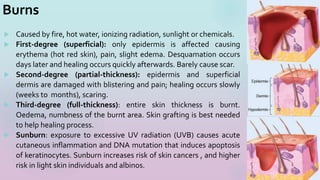 Burns
 Caused by fire, hot water, ionizing radiation, sunlight or chemicals.
 First-degree (superficial): only epidermis is affected causing
erythema (hot red skin), pain, slight edema. Desquamation occurs
days later and healing occurs quickly afterwards. Barely cause scar.
 Second-degree (partial-thickness): epidermis and superficial
dermis are damaged with blistering and pain; healing occurs slowly
(weeks to months), scaring.
 Third-degree (full-thickness): entire skin thickness is burnt.
Oedema, numbness of the burnt area. Skin grafting is best needed
to help healing process.
 Sunburn: exposure to excessive UV radiation (UVB) causes acute
cutaneous inflammation and DNA mutation that induces apoptosis
of keratinocytes. Sunburn increases risk of skin cancers , and higher
risk in light skin individuals and albinos.
21
 