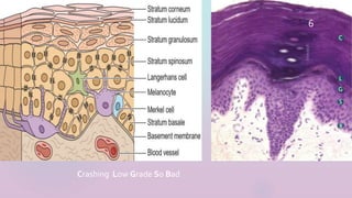 6
Crashing Low Grade So Bad
 