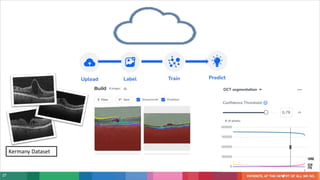 27
Kermany Dataset
• Segment
• Obj Detection ROI
• Visual Prompting
 