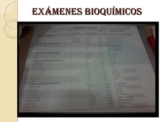 EXÁMENES BIOQUÍMICOSEXÁMENES BIOQUÍMICOS
 