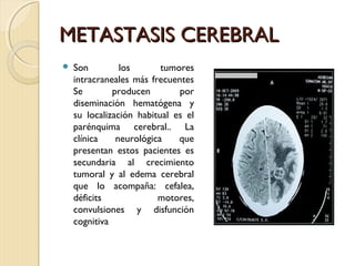 METASTASIS CEREBRALMETASTASIS CEREBRAL
 Son los tumores
intracraneales más frecuentes
Se producen por
diseminación hematógena y
su localización habitual es el
parénquima cerebral.. La
clínica neurológica que
presentan estos pacientes es
secundaria al crecimiento
tumoral y al edema cerebral
que lo acompaña: cefalea,
déficits motores,
convulsiones y disfunción
cognitiva
 