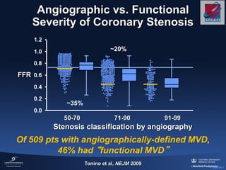 3056029-1
Angiographic vs. Functional
Severity of Coronary Stenosis
Of 509 pts with angiographically-defined MVD,
46% had “functional MVD”
FFR
50-70 71-90 91-99
Stenosis classification by angiography
~20%
~35%
Tonino et al, NEJM 2009
 