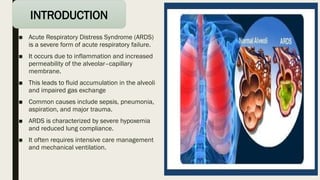Comprehensive Overview of Acute Respiratory Distress Syndrome (ARDS ...