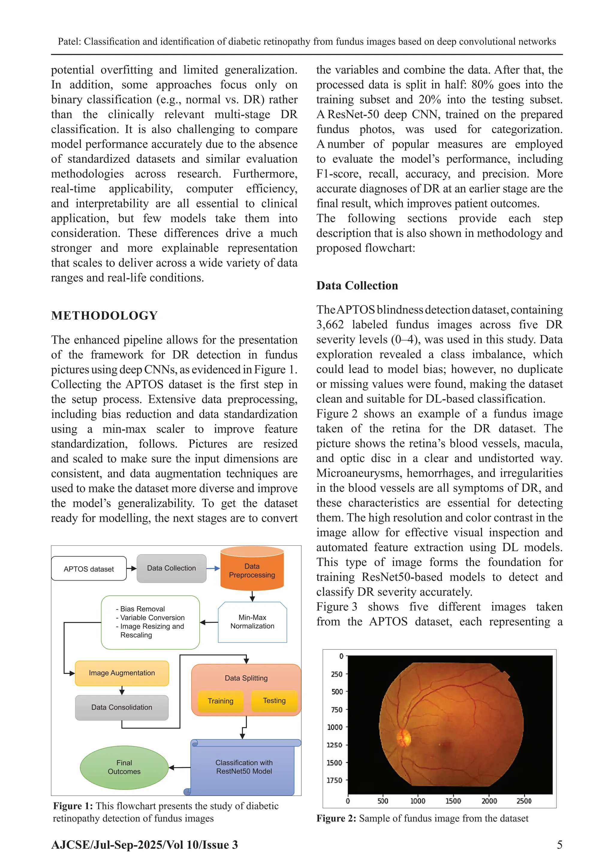 Patel: Classification and identification of diabetic retinopathy from fundus images based on deep convolutional networks
AJCSE/Jul-Sep-2025/Vol 10/Issue 3 5
potential overfitting and limited generalization.
In addition, some approaches focus only on
binary classification (e.g., normal vs. DR) rather
than the clinically relevant multi-stage DR
classification. It is also challenging to compare
model performance accurately due to the absence
of standardized datasets and similar evaluation
methodologies across research. Furthermore,
real-time applicability, computer efficiency,
and interpretability are all essential to clinical
application, but few models take them into
consideration. These differences drive a much
stronger and more explainable representation
that scales to deliver across a wide variety of data
ranges and real-life conditions.
METHODOLOGY
The enhanced pipeline allows for the presentation
of the framework for DR detection in fundus
picturesusingdeepCNNs,asevidencedinFigure 1.
Collecting the APTOS dataset is the first step in
the setup process. Extensive data preprocessing,
including bias reduction and data standardization
using a min-max scaler to improve feature
standardization, follows. Pictures are resized
and scaled to make sure the input dimensions are
consistent, and data augmentation techniques are
used to make the dataset more diverse and improve
the model’s generalizability. To get the dataset
ready for modelling, the next stages are to convert
the variables and combine the data. After that, the
processed data is split in half: 80% goes into the
training subset and 20% into the testing subset.
A ResNet-50 deep CNN, trained on the prepared
fundus photos, was used for categorization.
A number of popular measures are employed
to evaluate the model’s performance, including
F1-score, recall, accuracy, and precision. More
accurate diagnoses of DR at an earlier stage are the
final result, which improves patient outcomes.
The following sections provide each step
description that is also shown in methodology and
proposed flowchart:
Data Collection
TheAPTOSblindnessdetectiondataset,containing
3,662 labeled fundus images across five DR
severity levels (0–4), was used in this study. Data
exploration revealed a class imbalance, which
could lead to model bias; however, no duplicate
or missing values were found, making the dataset
clean and suitable for DL-based classification.
Figure 2 shows an example of a fundus image
taken of the retina for the DR dataset. The
picture shows the retina’s blood vessels, macula,
and optic disc in a clear and undistorted way.
Microaneurysms, hemorrhages, and irregularities
in the blood vessels are all symptoms of DR, and
these characteristics are essential for detecting
them. The high resolution and color contrast in the
image allow for effective visual inspection and
automated feature extraction using DL models.
This type of image forms the foundation for
training ResNet50-based models to detect and
classify DR severity accurately.
Figure 3 shows five different images taken
from the APTOS dataset, each representing a
Figure 2: Sample of fundus image from the dataset
APTOS dataset Data Collection Data
Preprocessing
- Bias Removal
- Variable Conversion
- Image Resizing and
Rescaling
Min-Max
Normalization
Image Augmentation
Data Consolidation
Data Splitting
Training Testing
Classification with
RestNet50 Model
Final
Outcomes
Figure 1: This flowchart presents the study of diabetic
retinopathy detection of fundus images
 